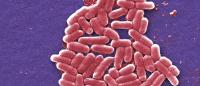E. coli bacteria as seen under a microscope
